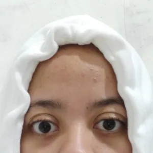 Hum aku bingung