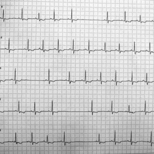 Musikalisasi Puisi Aritmia karya Wira Nagara