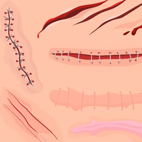 Ep 05: Tanpa Jahitan