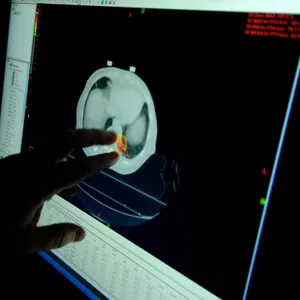 The unique needs of young cancer survivors are often overlooked