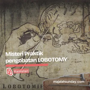 Kamisteri || Misteri Praktik pengobatan LOBOTOMY