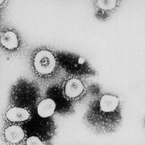 The Coronavirus Is Mutating. Here's What That Means.