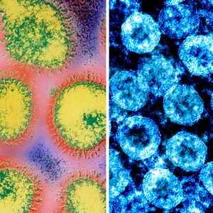 No, The Coronavirus Isn't Another Flu